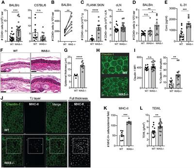 IL-17-Dependent Dysregulated Cutaneous Immune Homeostasis in the Absence of the Wiskott–Aldrich Syndrome Protein